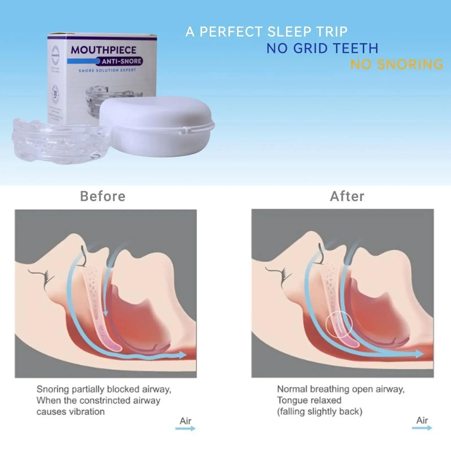 Anti-Snoring Mouthpiece - Natural Way to Sleep Better