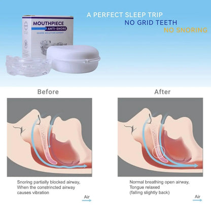 Anti-Snoring Mouthpiece - Natural Way to Sleep Better